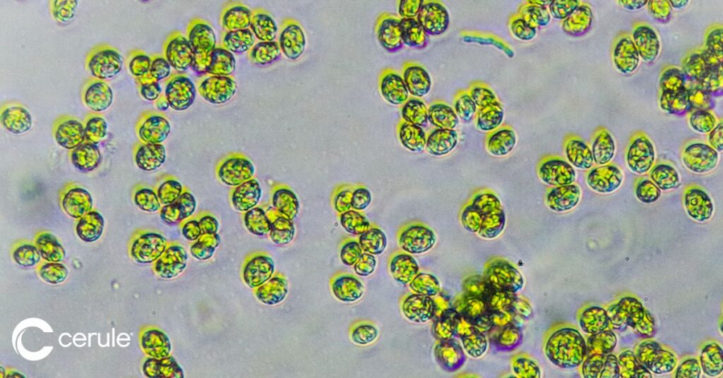 microscopic image of AFA